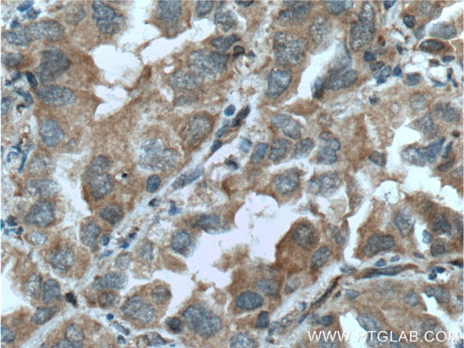 PLAA Antibody in Immunohistochemistry (Paraffin) (IHC (P))