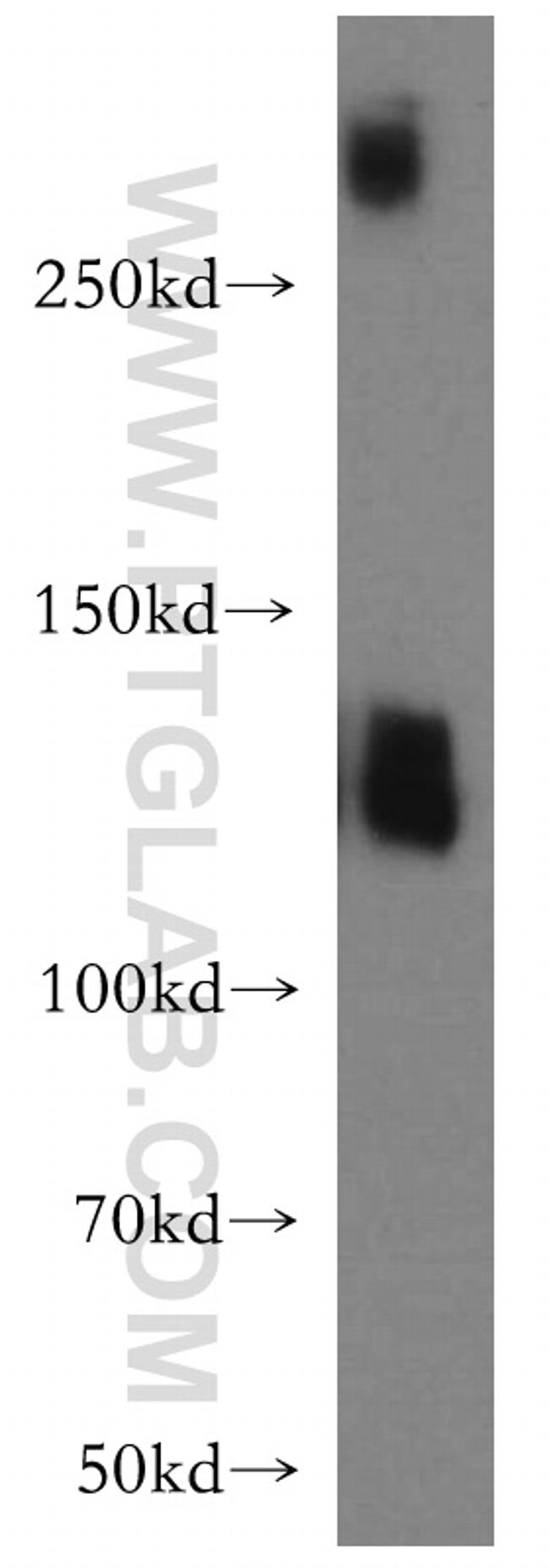 SLC4A8 Antibody in Western Blot (WB)