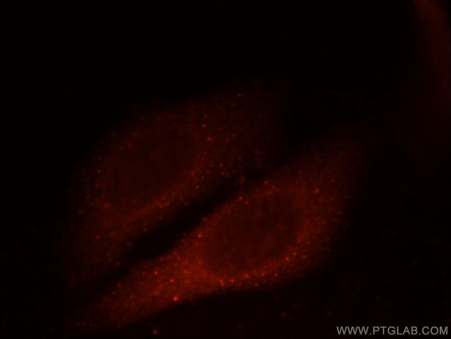 GAGE2D Antibody in Immunocytochemistry (ICC/IF)