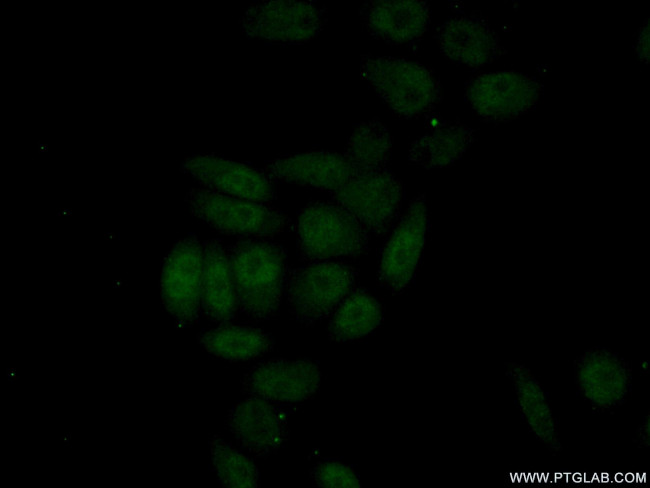 HNF1B Antibody in Immunocytochemistry (ICC/IF)