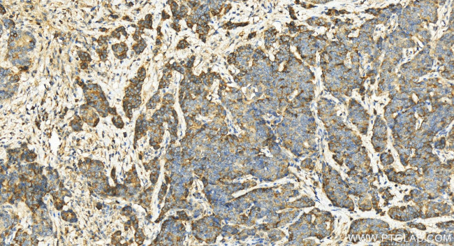 RGS1 Antibody in Immunohistochemistry (Paraffin) (IHC (P))