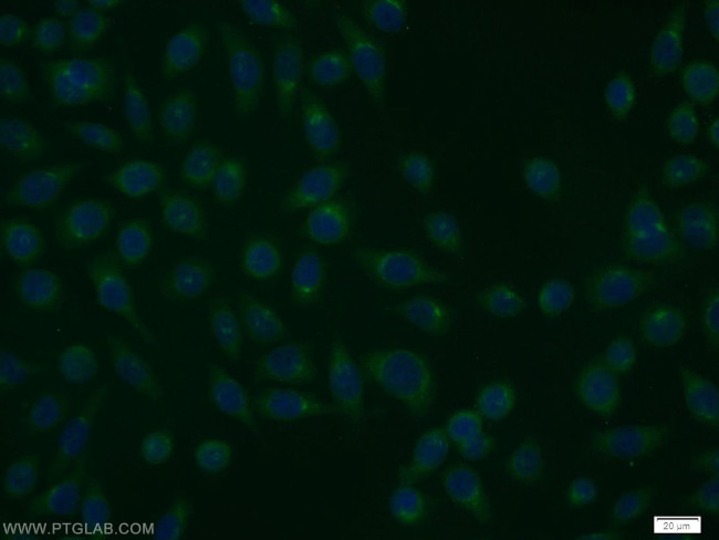 RGS17 Antibody in Immunocytochemistry (ICC/IF)