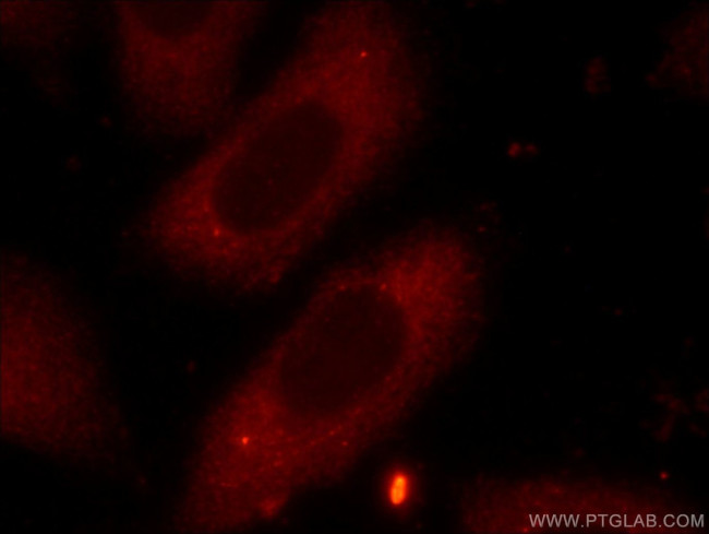 FXR2 Antibody in Immunocytochemistry (ICC/IF)