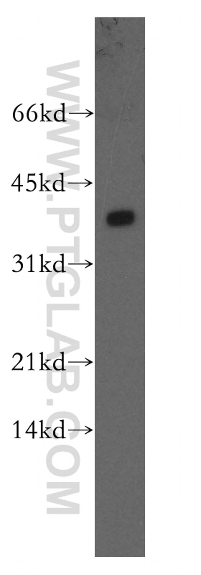PPP2CB Antibody in Western Blot (WB)