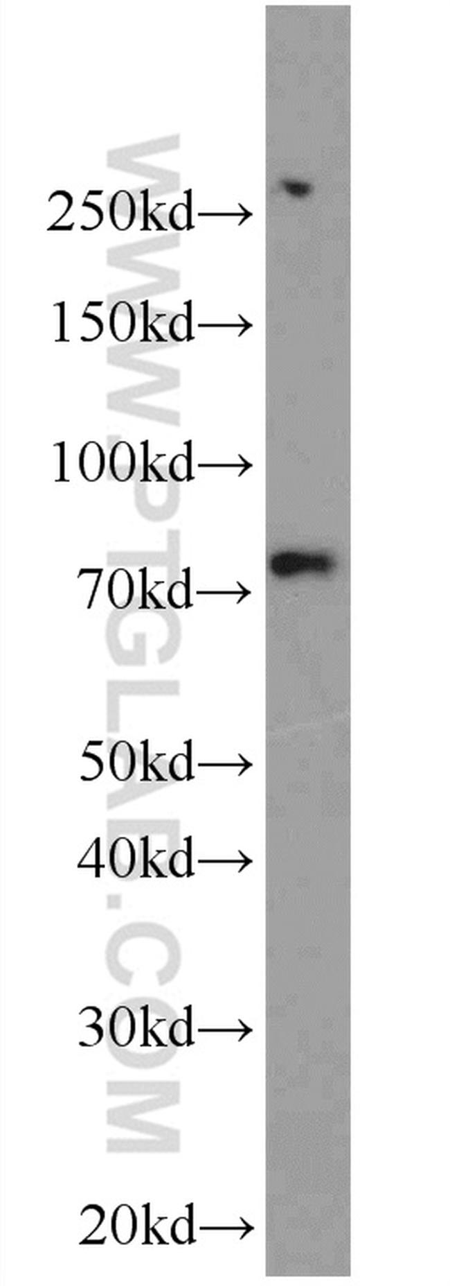 RAPGEF5 Antibody in Western Blot (WB)