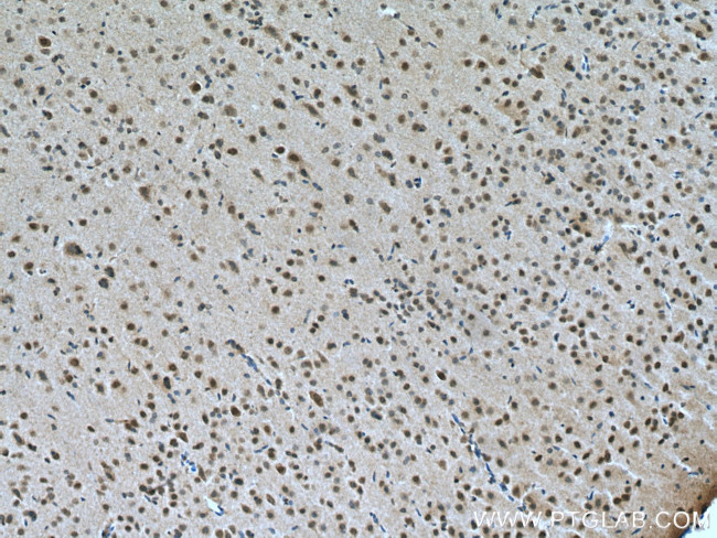 PRMT8 Antibody in Immunohistochemistry (Paraffin) (IHC (P))