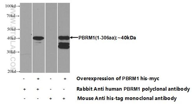 PBRM1 Antibody in Western Blot (WB)