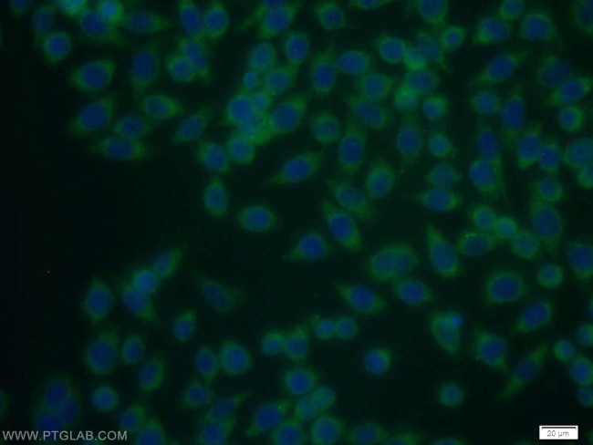 TSP50 Antibody in Immunocytochemistry (ICC/IF)