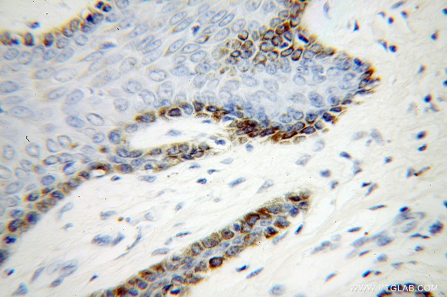 UBE2Q2 Antibody in Immunohistochemistry (Paraffin) (IHC (P))