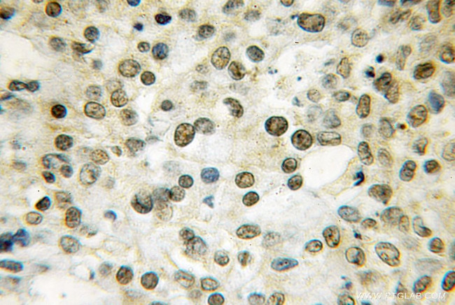 THAP1 Antibody in Immunohistochemistry (Paraffin) (IHC (P))
