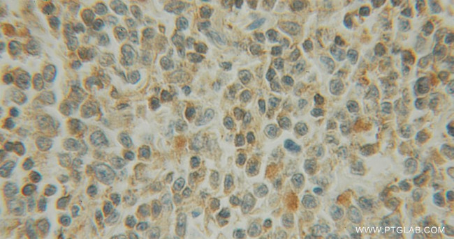 EXOSC1 Antibody in Immunohistochemistry (Paraffin) (IHC (P))