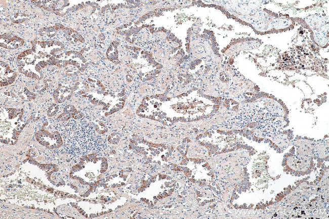 CRABP1 Antibody in Immunohistochemistry (Paraffin) (IHC (P))