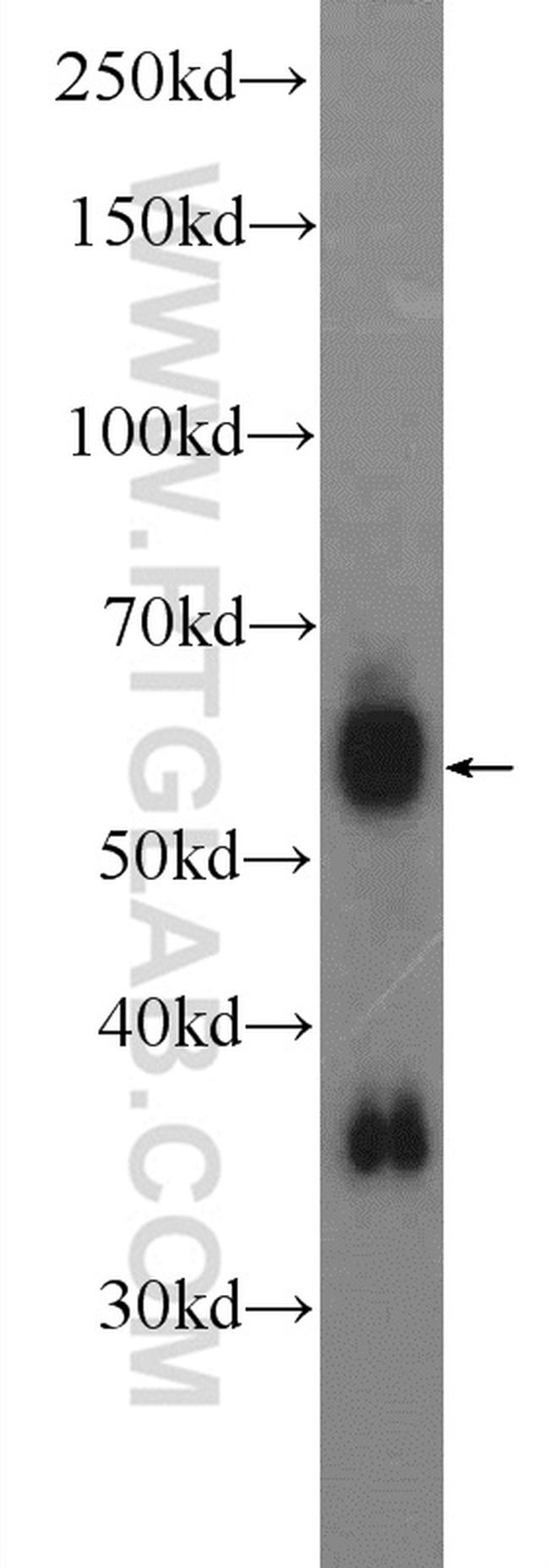 PPIL2 Antibody in Western Blot (WB)