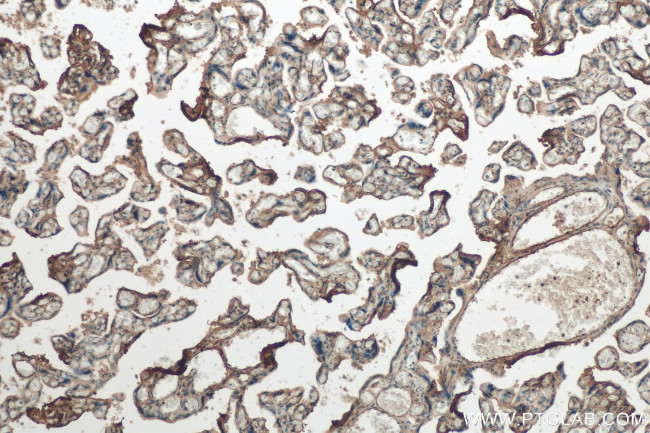 Integrin beta-1 Antibody in Immunohistochemistry (Paraffin) (IHC (P))