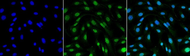 MDC1 Antibody in Immunocytochemistry (ICC/IF)