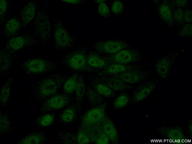 GABPB1 Antibody in Immunocytochemistry (ICC/IF)