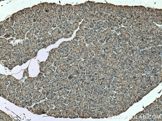 CPB1 Antibody in Immunohistochemistry (Paraffin) (IHC (P))