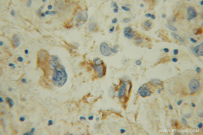 MAOB Antibody in Immunohistochemistry (Paraffin) (IHC (P))