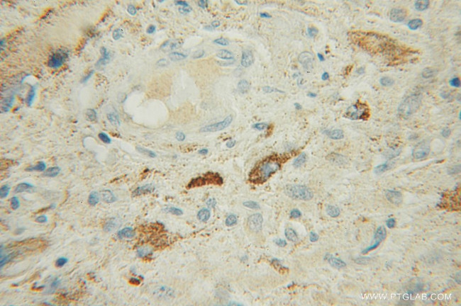 IPPK Antibody in Immunohistochemistry (Paraffin) (IHC (P))