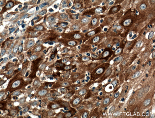 IFIT2 Antibody in Immunohistochemistry (Paraffin) (IHC (P))