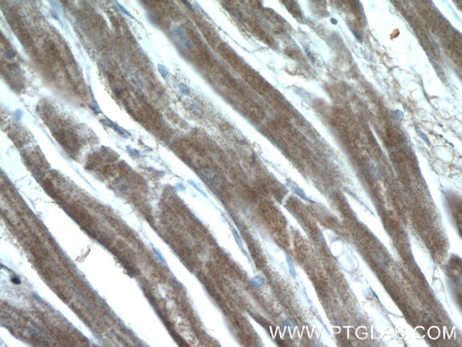 GUCY1A3 Antibody in Immunohistochemistry (Paraffin) (IHC (P))