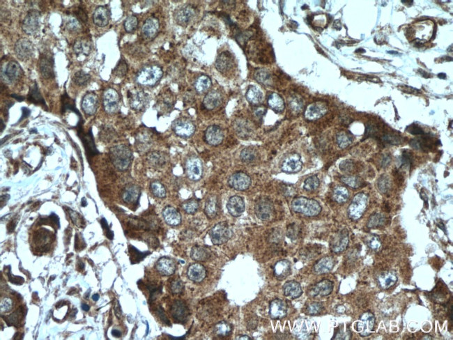 TRPC4AP Antibody in Immunohistochemistry (Paraffin) (IHC (P))
