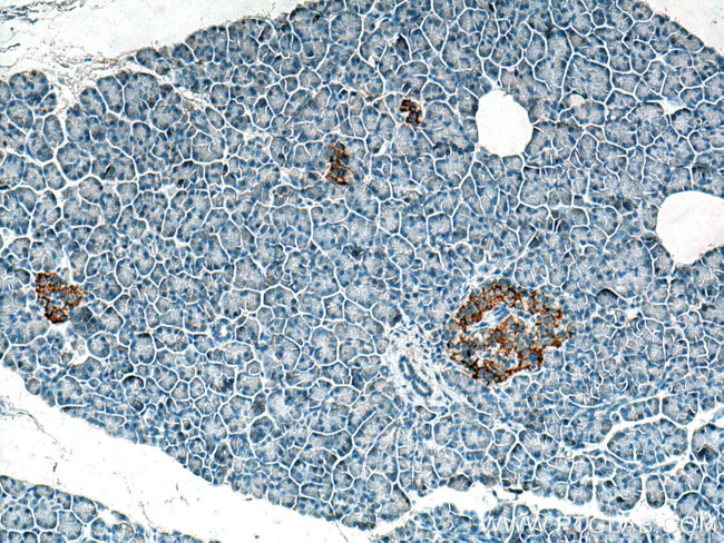 ACVR1C Antibody in Immunohistochemistry (Paraffin) (IHC (P))