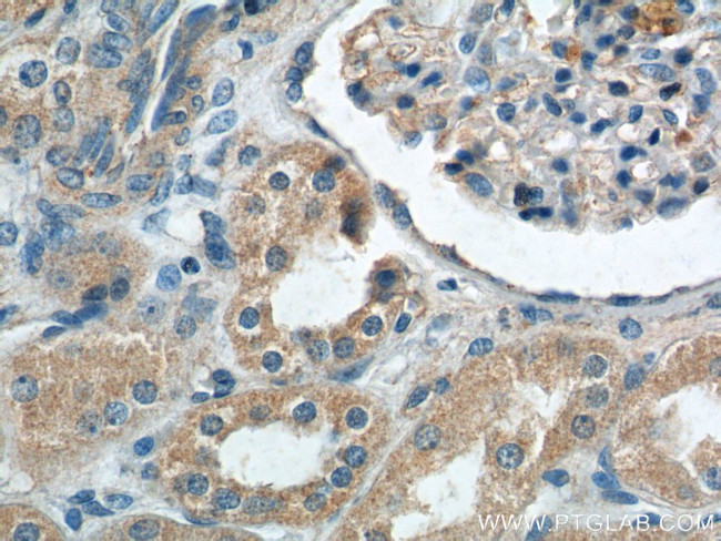 ECOP Antibody in Immunohistochemistry (Paraffin) (IHC (P))