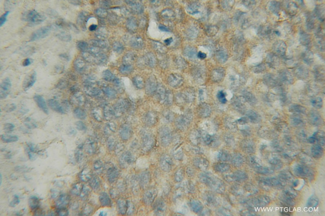 PIGB Antibody in Immunohistochemistry (Paraffin) (IHC (P))