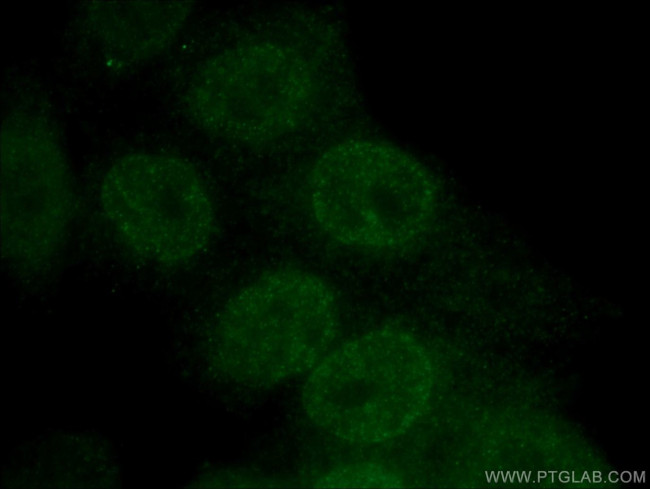 HOXB7 Antibody in Immunocytochemistry (ICC/IF)
