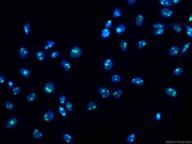 MKI67IP Antibody in Immunocytochemistry (ICC/IF)