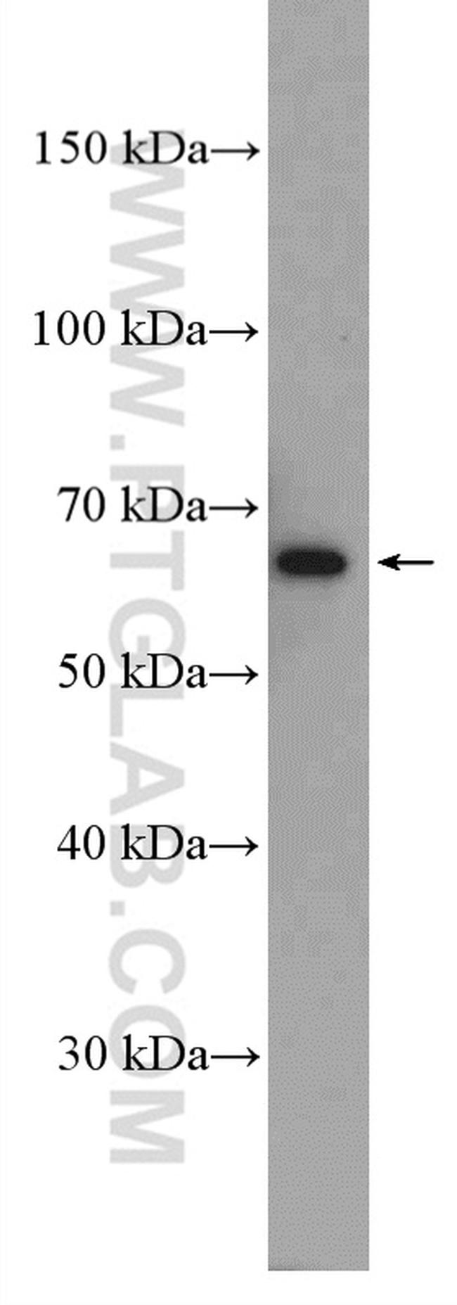 VPS45 Antibody in Western Blot (WB)