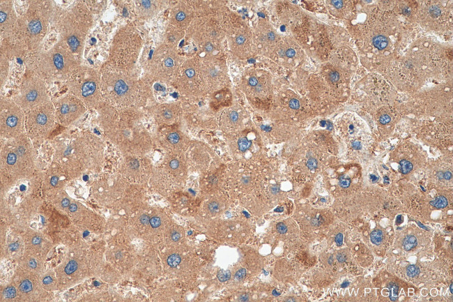 PPP2R1B Antibody in Immunohistochemistry (Paraffin) (IHC (P))