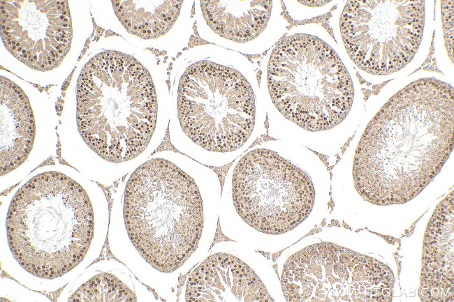 RFX2 Antibody in Immunohistochemistry (Paraffin) (IHC (P))