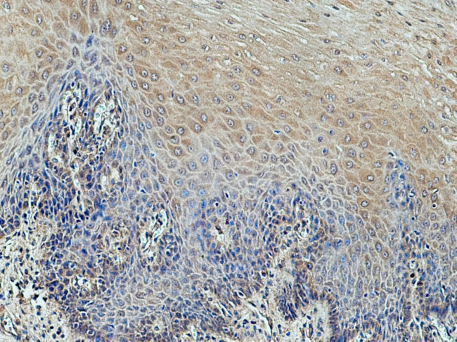 DIRAS1 Antibody in Immunohistochemistry (Paraffin) (IHC (P))
