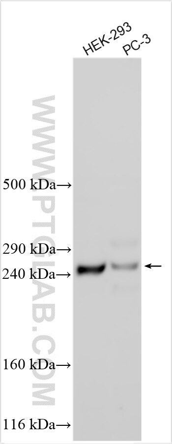 PDE4DIP Antibody in Western Blot (WB)