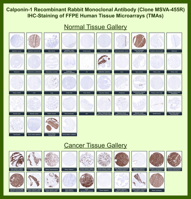 Calponin-1 (Smooth Muscle Marker) Antibody in Immunohistochemistry (Paraffin) (IHC (P))