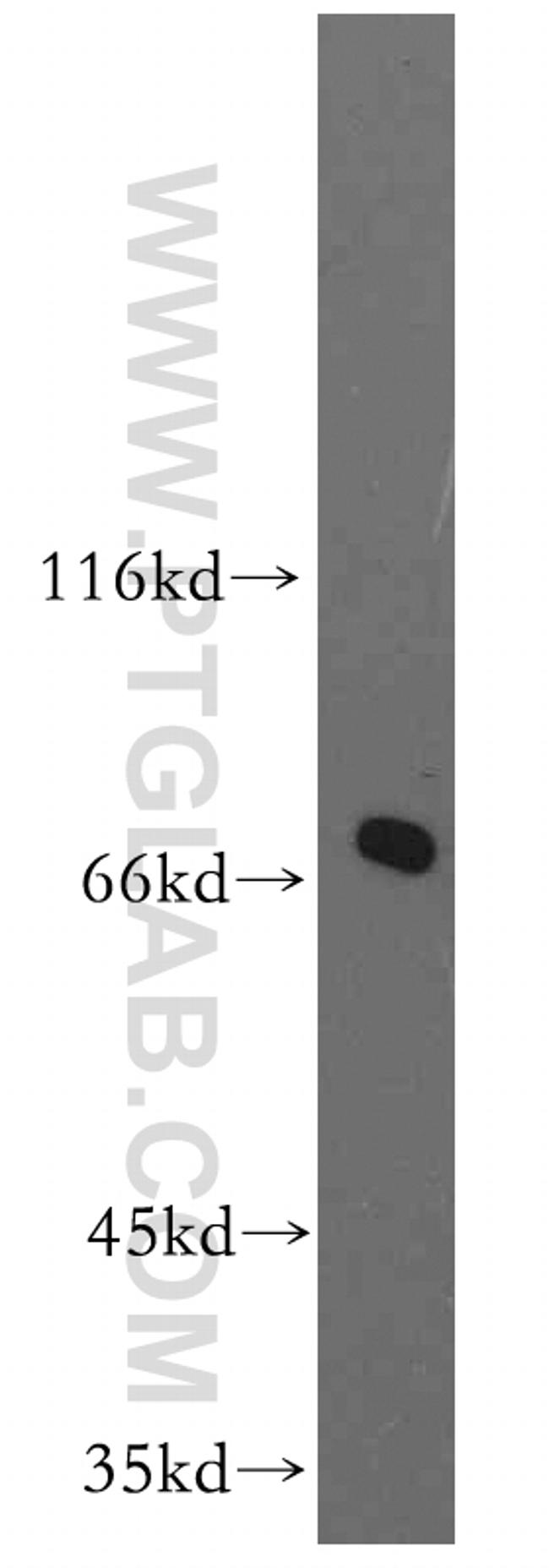 SHC4 Antibody in Western Blot (WB)