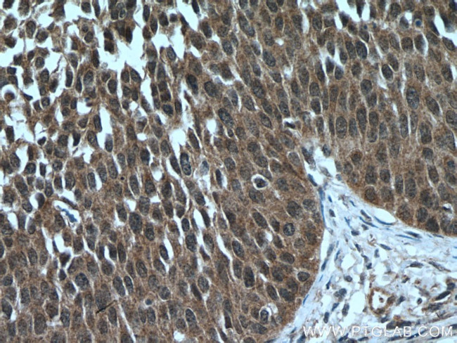 ARMC8 Antibody in Immunohistochemistry (Paraffin) (IHC (P))