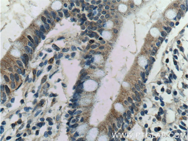 Kir7.1 Antibody in Immunohistochemistry (Paraffin) (IHC (P))