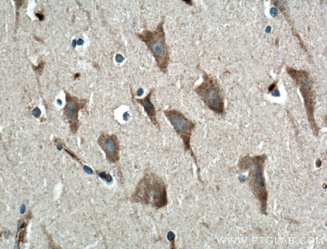 GPR155 Antibody in Immunohistochemistry (Paraffin) (IHC (P))