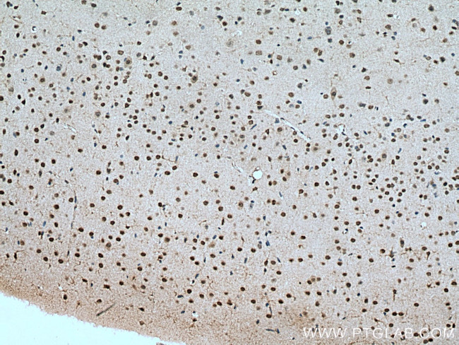 DBP Antibody in Immunohistochemistry (Paraffin) (IHC (P))