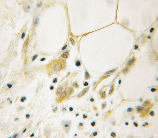 AGFG1 Antibody in Immunohistochemistry (Paraffin) (IHC (P))