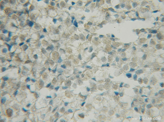 BRSK1 Antibody in Immunohistochemistry (Paraffin) (IHC (P))