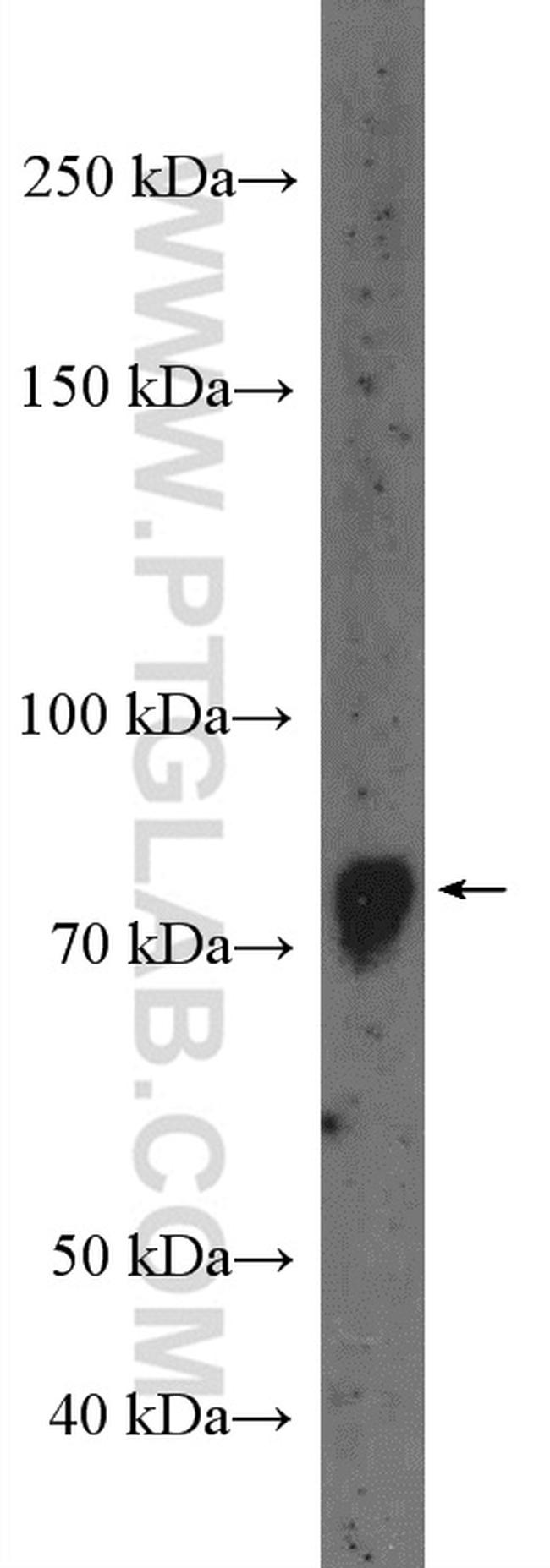 GLIS3 Antibody in Western Blot (WB)