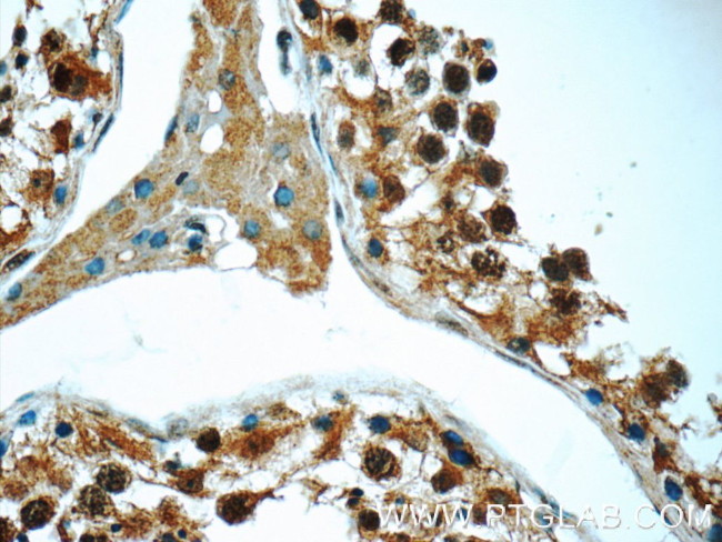MNS1 Antibody in Immunohistochemistry (Paraffin) (IHC (P))