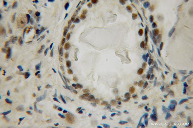 LIG4 Antibody in Immunohistochemistry (Paraffin) (IHC (P))