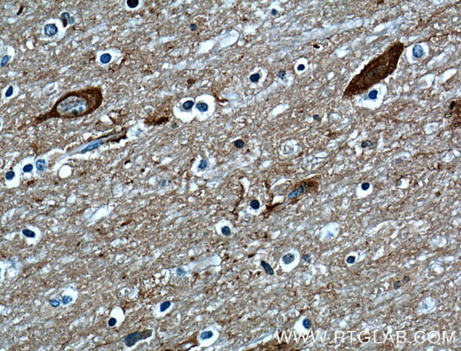 OMG Antibody in Immunohistochemistry (Paraffin) (IHC (P))