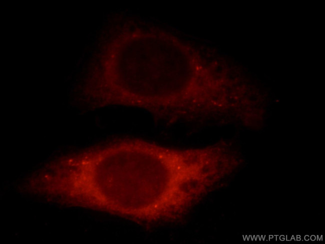 SHKBP1 Antibody in Immunocytochemistry (ICC/IF)
