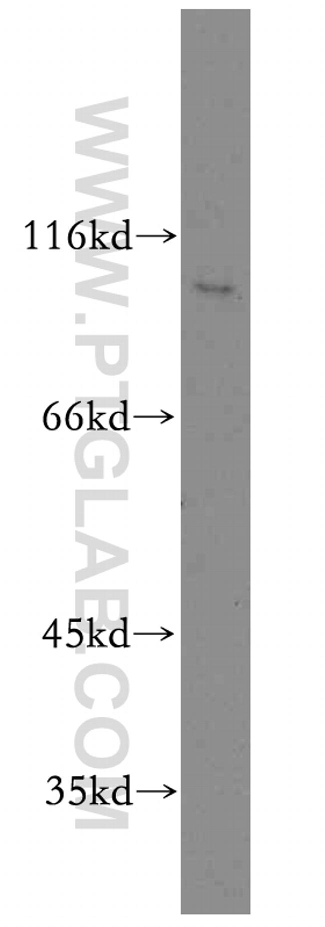 RIN3 Antibody in Western Blot (WB)
